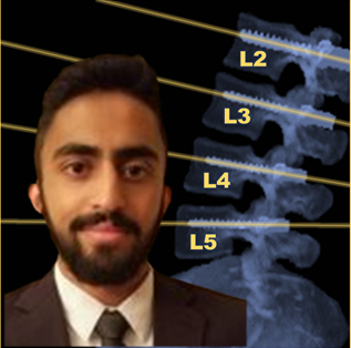 Read more about the article Paper by Rohan Vijayan Yields a Method for Automatic Planning in Spine Surgery